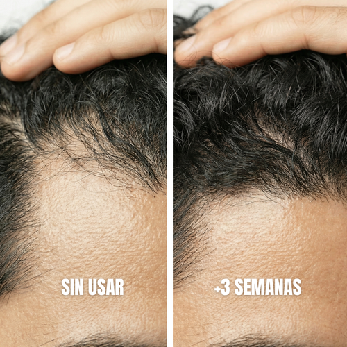 Shampoo Anticaída- Expertos en reducir las entradas